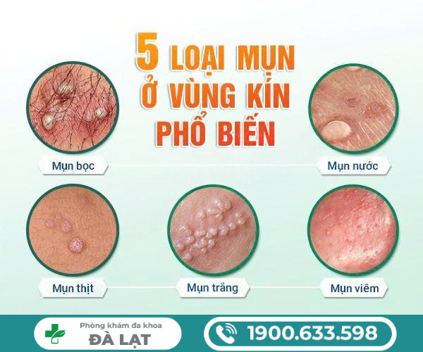 Hình ảnh minh họa